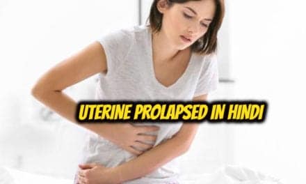 बच्चेदानी (गर्भाशय) बाहर आना – Uterine Prolapsed in hindi