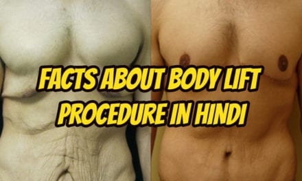 बॉडी लिफ्ट प्रक्रिया – Facts about body lift procedure in hindi