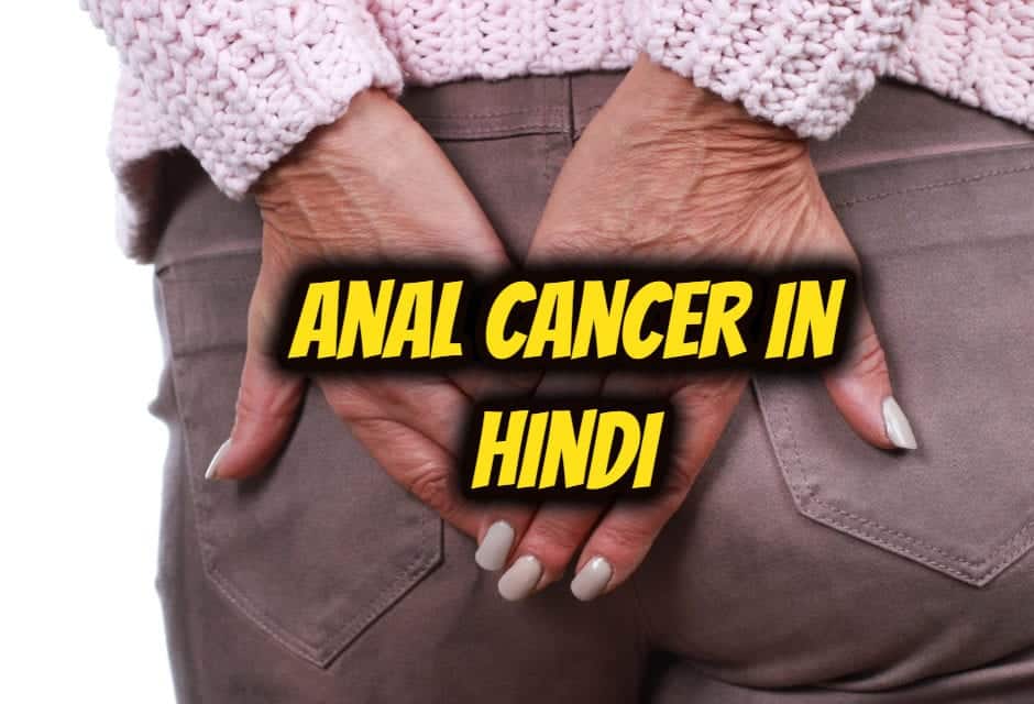 मलाशय (गुदा) कैंसर के बारे में सबकुछ – anal cancer in hindi