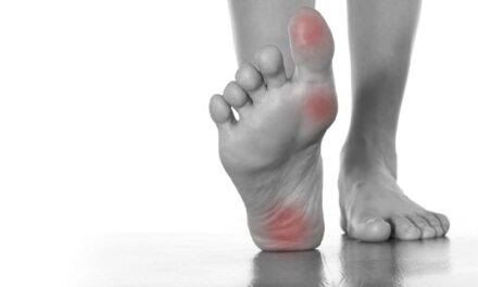 फुट आर्क में दर्द के कारण, निदान, घरेलू उपचार, ट्रीटमेंट, रिकवरी और बचाव – Pain in foot arch