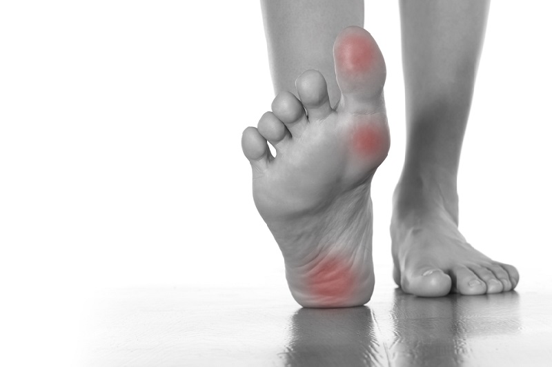 फुट आर्क में दर्द के कारण, निदान, घरेलू उपचार, ट्रीटमेंट, रिकवरी और बचाव – Pain in foot arch