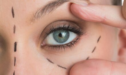 आंखों के नीचे डार्क सर्कल के कारण, ट्रीटमेंट और घरेलू उपचार – Causes, Treatment and home remedies to get rid of dark circles