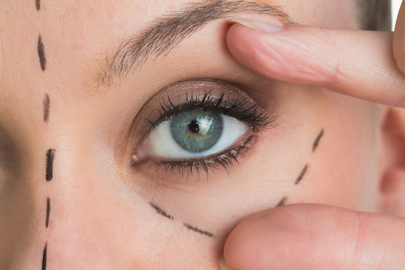 आंखों के नीचे डार्क सर्कल के कारण, ट्रीटमेंट और घरेलू उपचार – Causes, Treatment and home remedies to get rid of dark circles