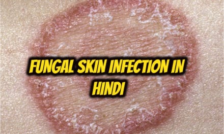 फंगल स्किन इंफेक्शन के बारे में – Fungal Skin Infection in hindi