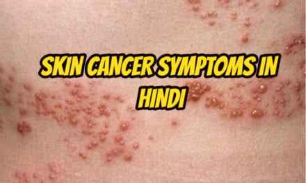 स्किन कैंसर के लक्षण – Skin cancer symptoms in hindi
