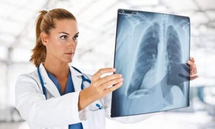 Lung cancer – Symptoms, Causes, Stage, Diagnosis, Treatment