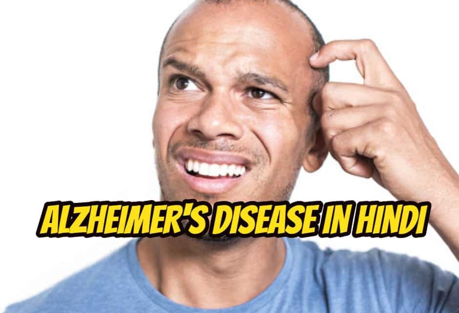 अल्ज़ाइमर रोग – alzheimer’s disease in hindi