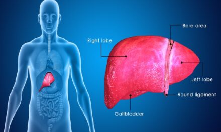 पित्त की थैली हटाने के साइड इफेक्ट – Gallbladder removal side effects in hindi