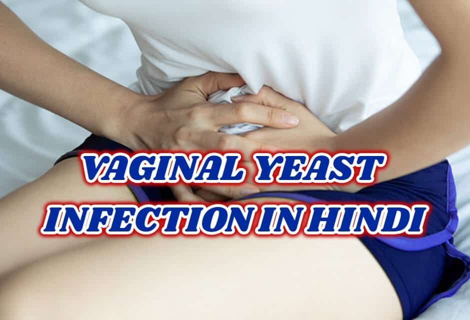 योनि यीस्ट इंफेक्शन – vaginal yeast infection in hindi
