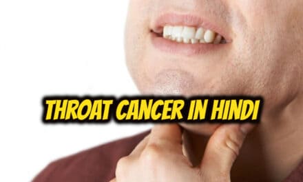 गले के कैंसर के बारे में – Throat Cancer in hindi