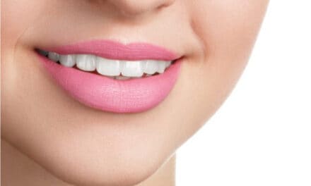लिप्स को पिंक कैसे करें – How to make Lips Pink
