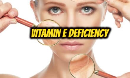 विटामिन ई की कमी – Vitamin E Deficiency