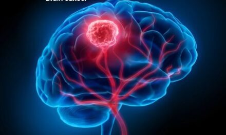 दिमाग का कैंसर – Brain Cancer
