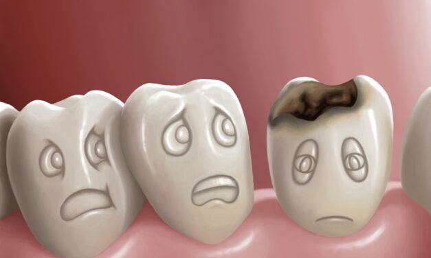 कैविटी से छुटकारा कैसे पाएं – How to Get Rid of Cavities at home