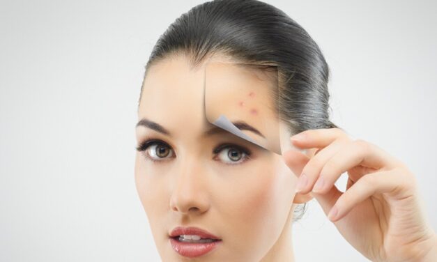 पिंपल के कारण होने वाले डार्क स्पॉट को कैसे हटाएं – How to remove dark spots caused by pimples