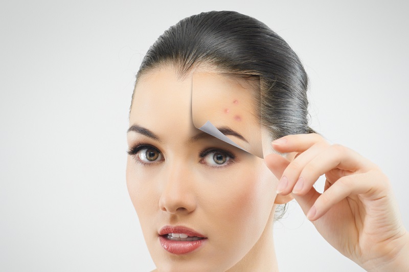 पिंपल के कारण होने वाले डार्क स्पॉट को कैसे हटाएं – How to remove dark spots caused by pimples